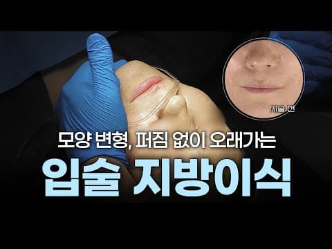 Video 2